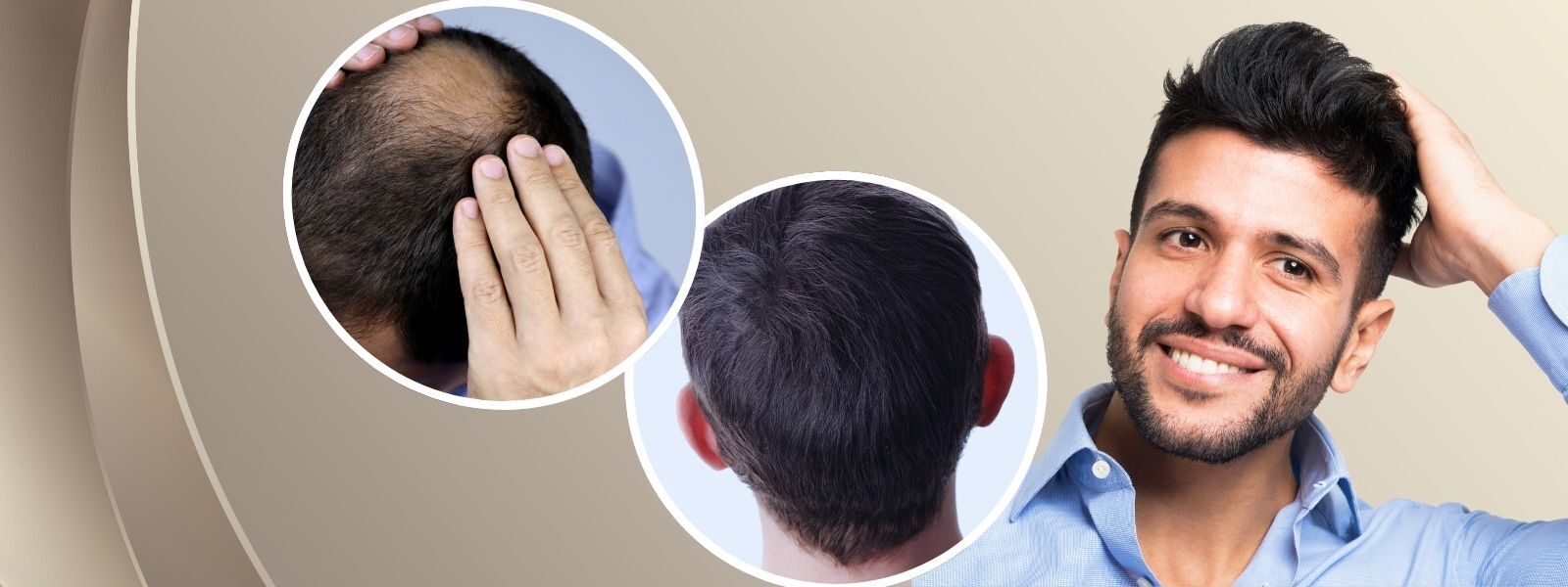 Hair Weaving Bangalore