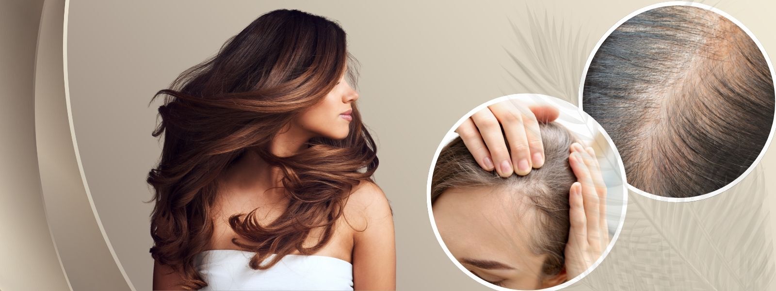 Hair Transplant Bangalore